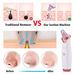 Blackhead Instrument Electric Suction Facial